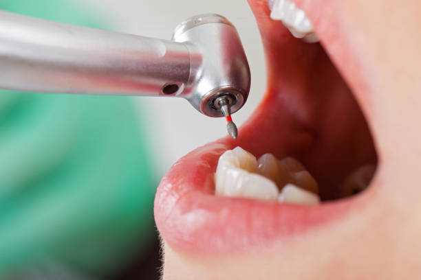 Best Emergency Dentist for Knocked-Out Tooth in Adamsville, TN